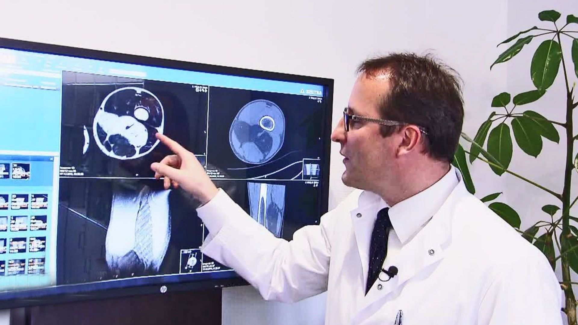 Frau von Lkw erfasst