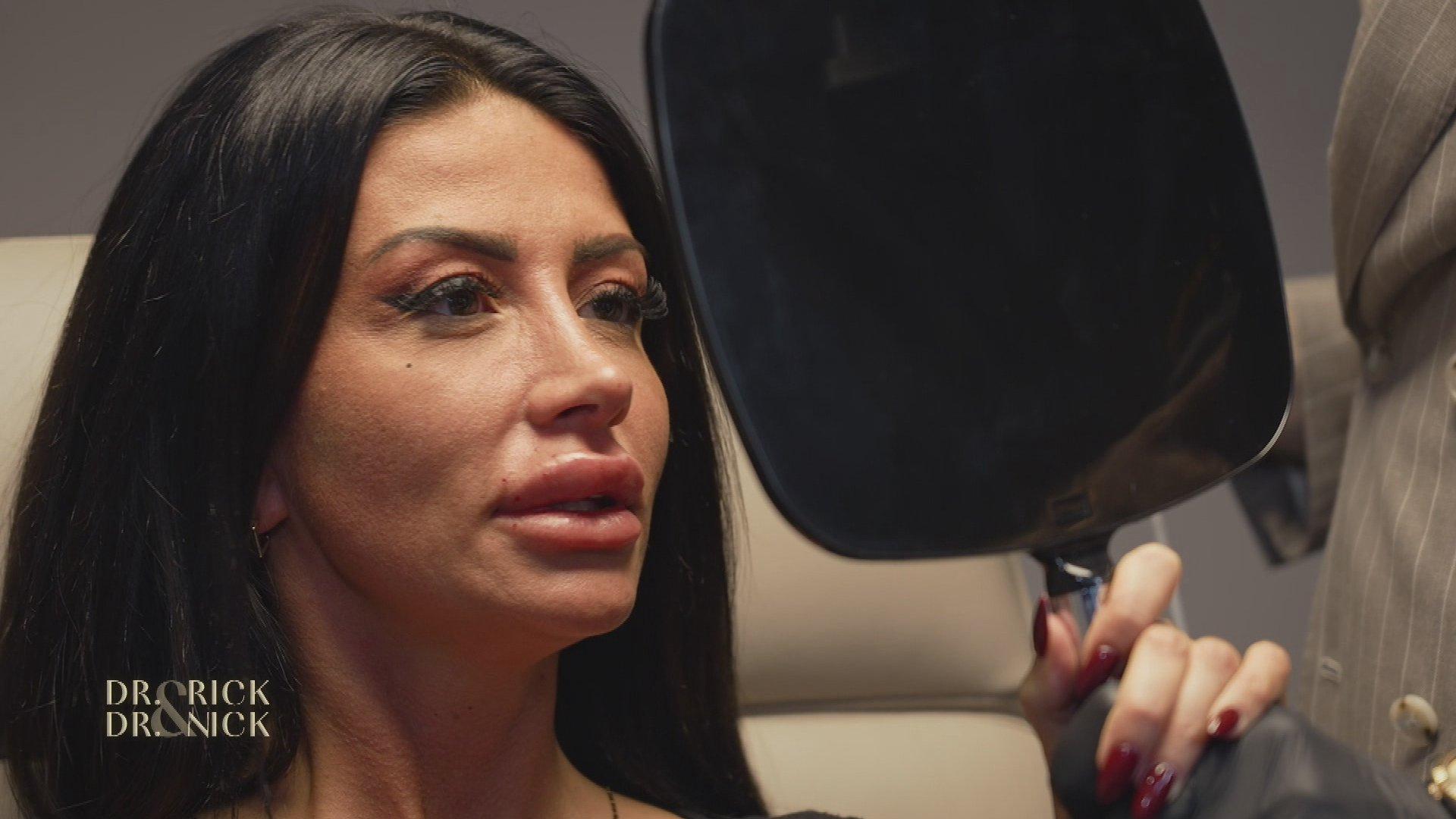 Groß, größer, XXL - Christina Dimitrious Verlangen nach größeren Lippen