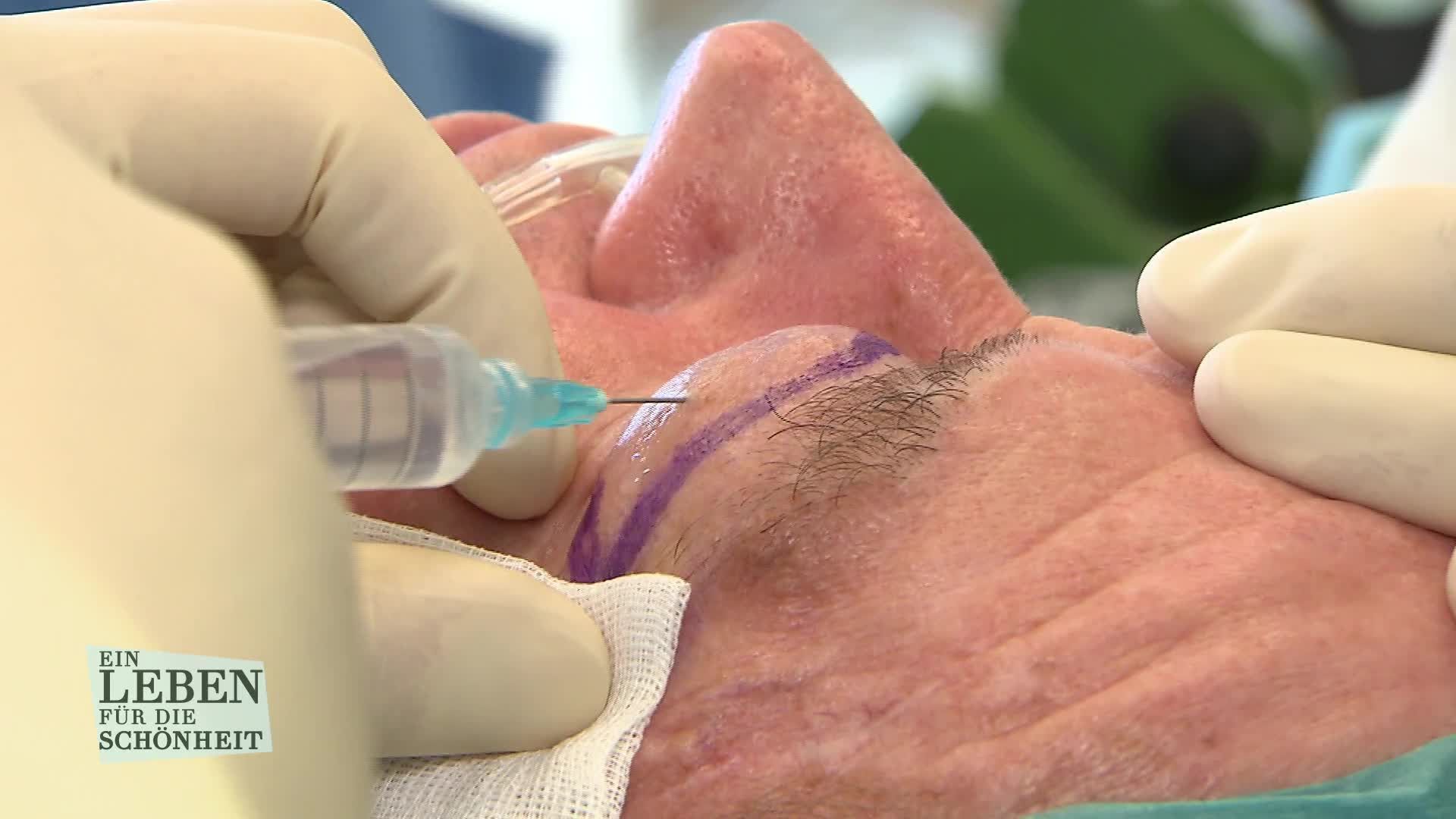 Staffel 6 Folge 5: Spritze rein, Augen fein?