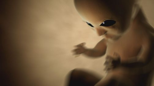 Unerklärliche Phänomene - Ancient Aliens Unerklärliche Phänomene - Ancient Aliens Folge 9: Infiziert