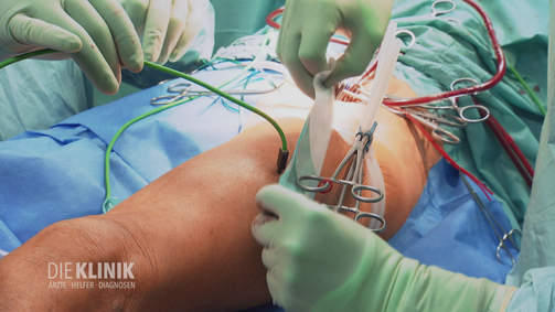 Die Klinik - Ärzte, Helfer, Diagnosen Staffel 1 Folge 5: Gezielte Vergiftung: riskante Heilmethode gegen Krebs