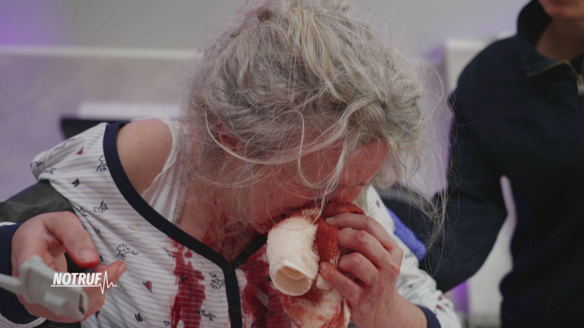 Gefährliches Nasenbluten