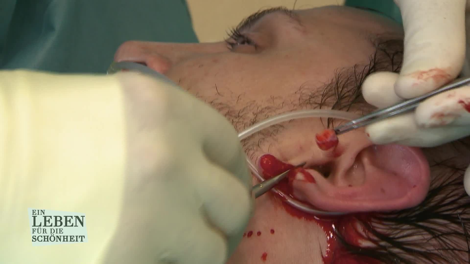 Staffel 6 Folge 4: Unerwünschte Löcher im Ohr