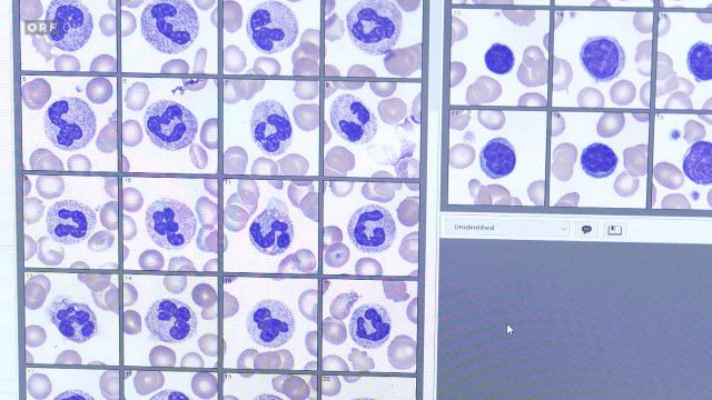 Bewusst Gesund - Das Magazin vom 10.01.2026