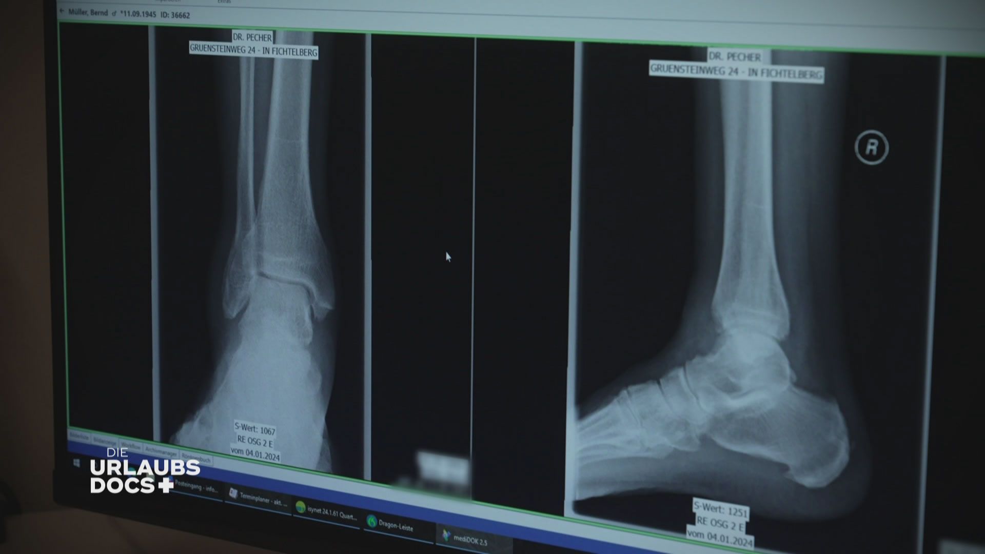 Fichtelberg: Patient mit Knöchelbruch