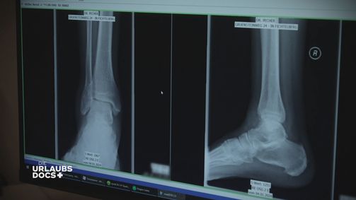 Die Urlaubs-Docs Die Urlaubs-Docs Folge 3: Fichtelberg: Patient mit Knöchelbruch