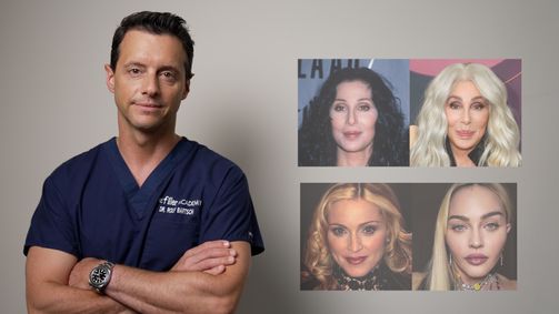 The Beauty Insider The Beauty Insider - Staffel 1 Folge 4: Staffel 1 Folge 4: Overfilled face syndrome