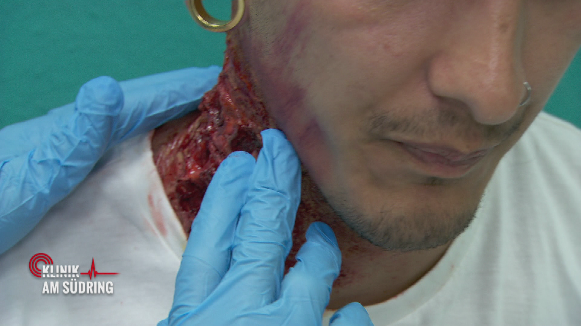 Feuer unterm Hintern