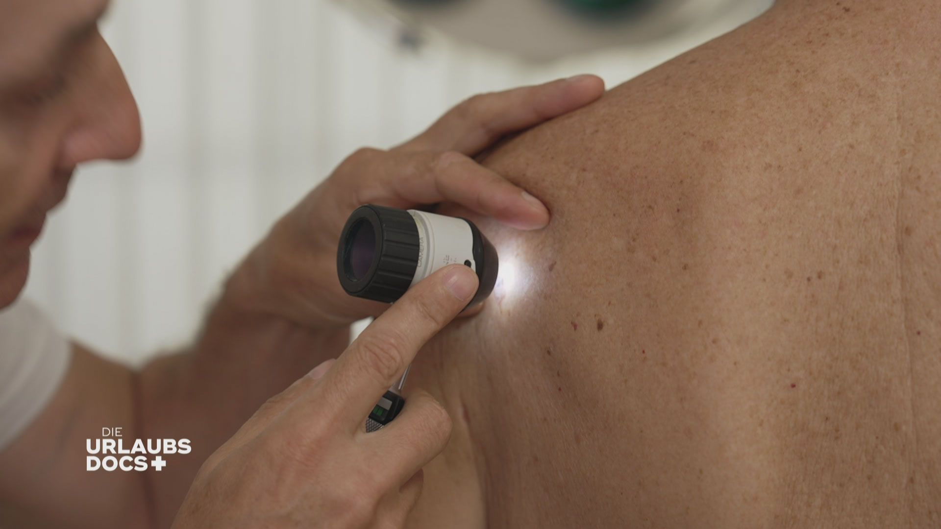 Fuerteventura: Auffälliges Muttermal am Rücken