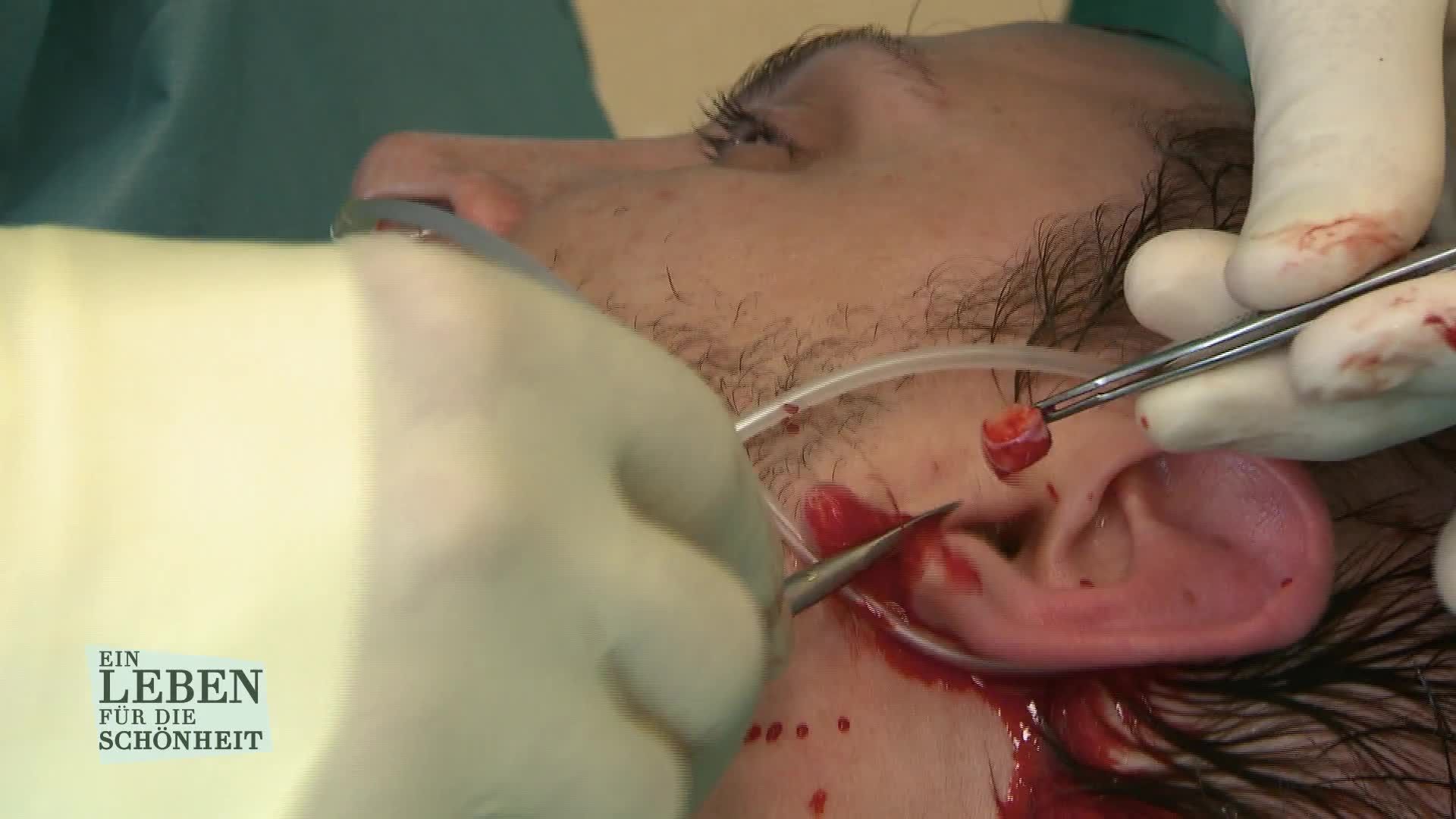 Staffel 6 Folge 4: Unerwünschte Löcher im Ohr