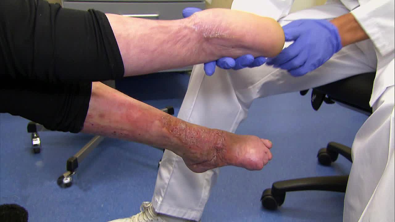 Heute u. a.: Letzte Hoffnung für ein afghanisches Mädchen