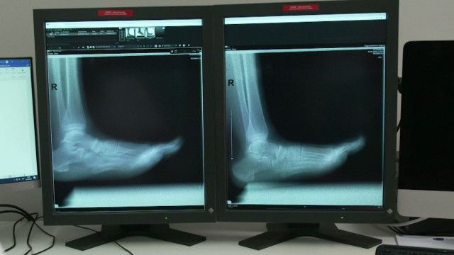 Wunder Du Clip: Knochen - Röntgen