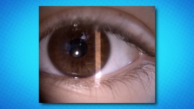 Wunder Du Clip: Auge