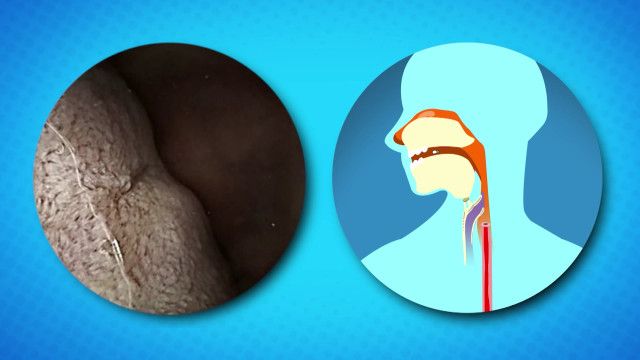 Wunder Du Clip: Verdauung - Mageninnere