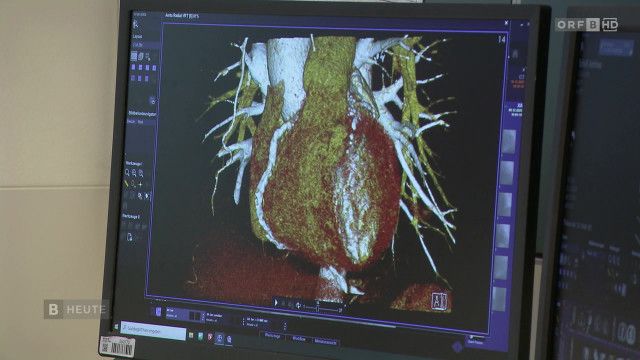 Burgenland heute vom 13.04.2026