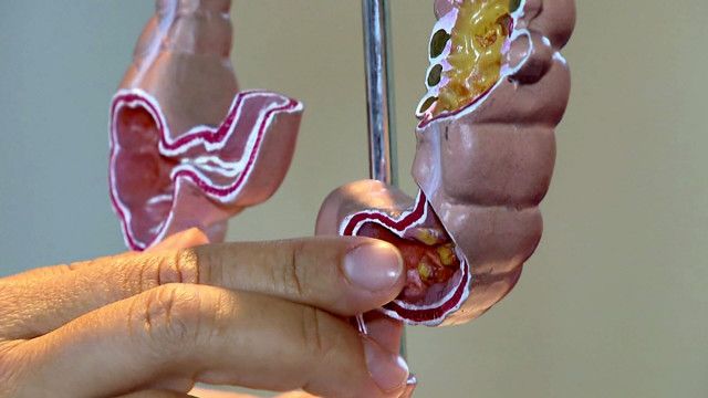 treffpunkt medizin: Bauchgehirn & Lebenszentrum: Der Darm