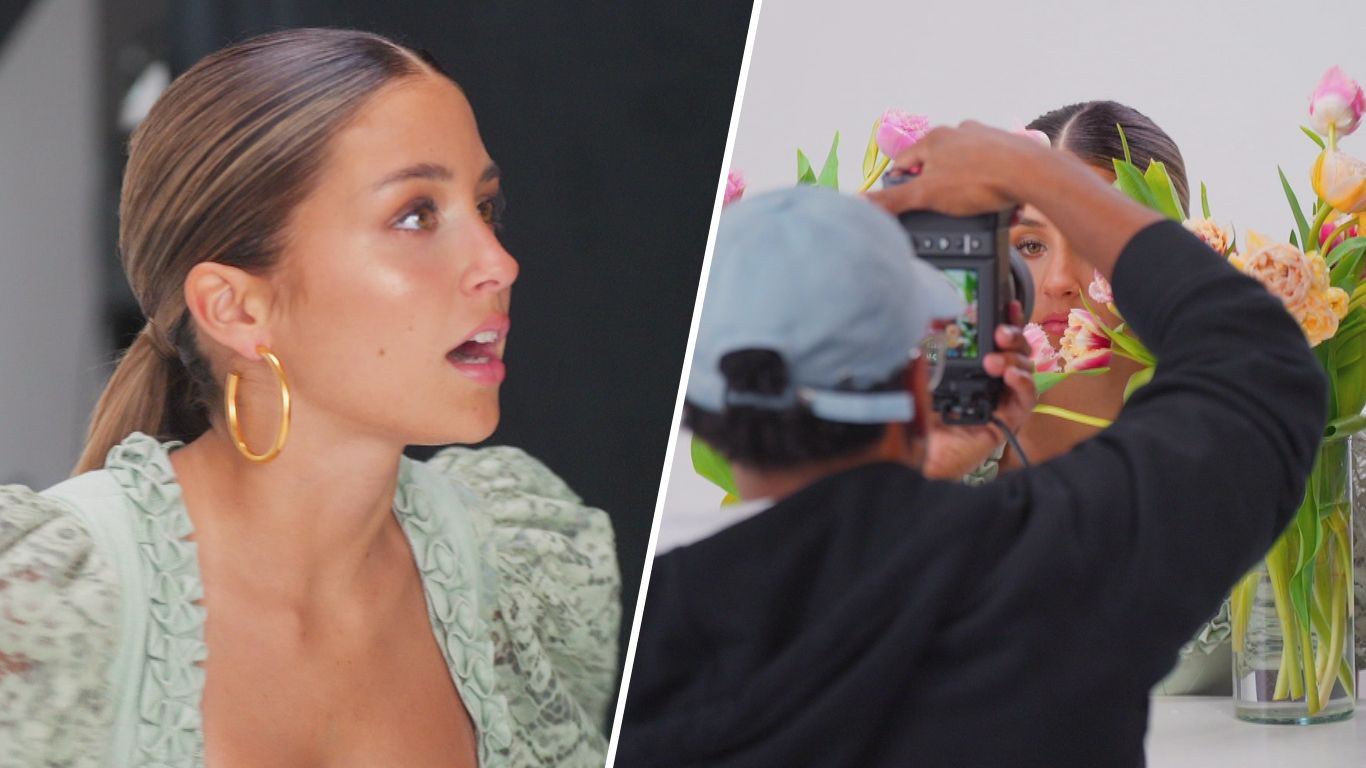 Der Schock beim Brand-Shooting: "Die Krankheit ist ein Teil von mir"