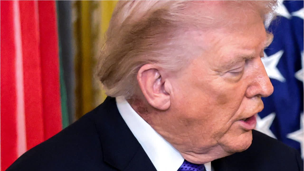 Trump hat auffällige Rötung am Hals