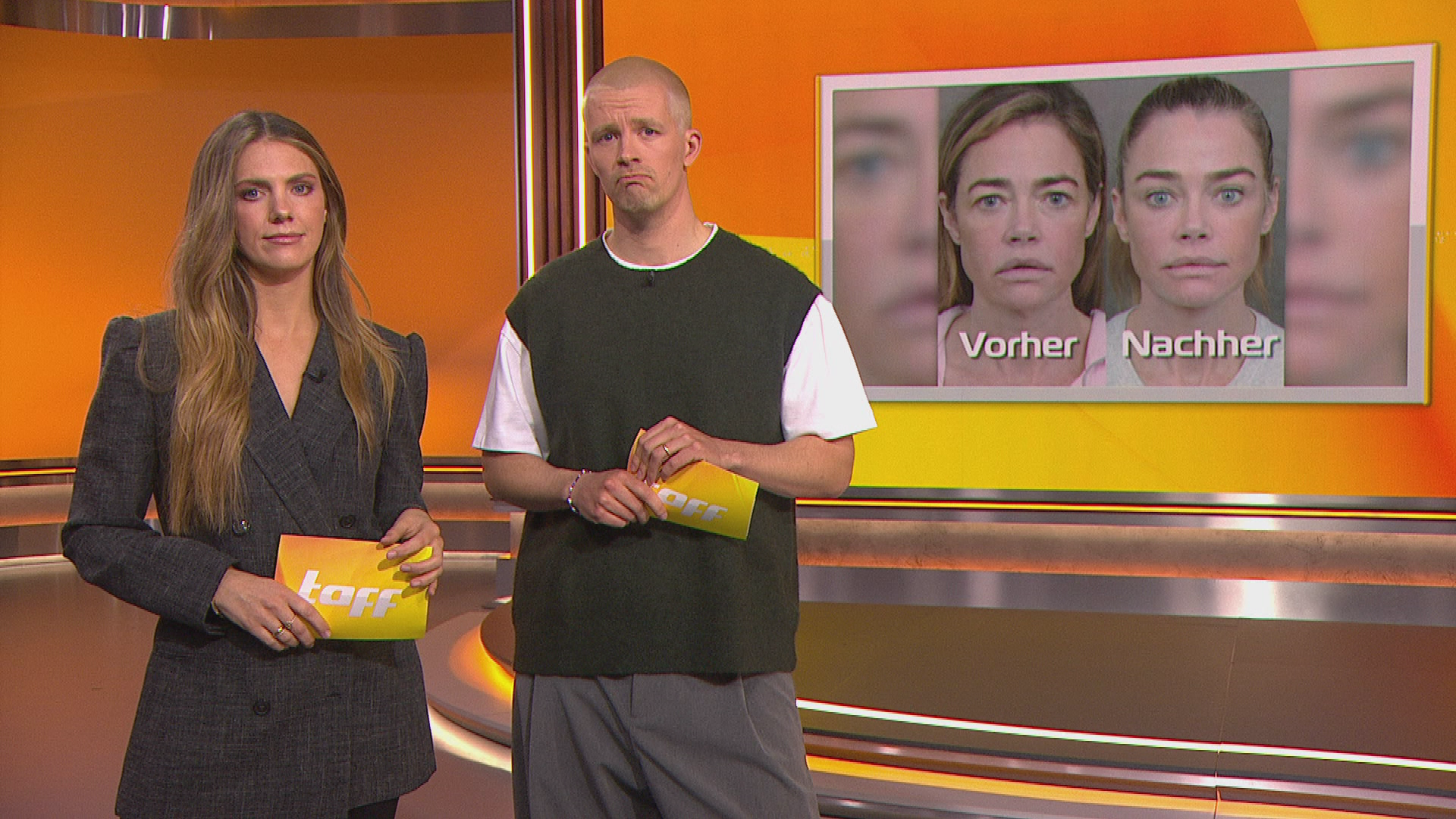 Schauspielerin Denise Richards macht Facelift öffentlich