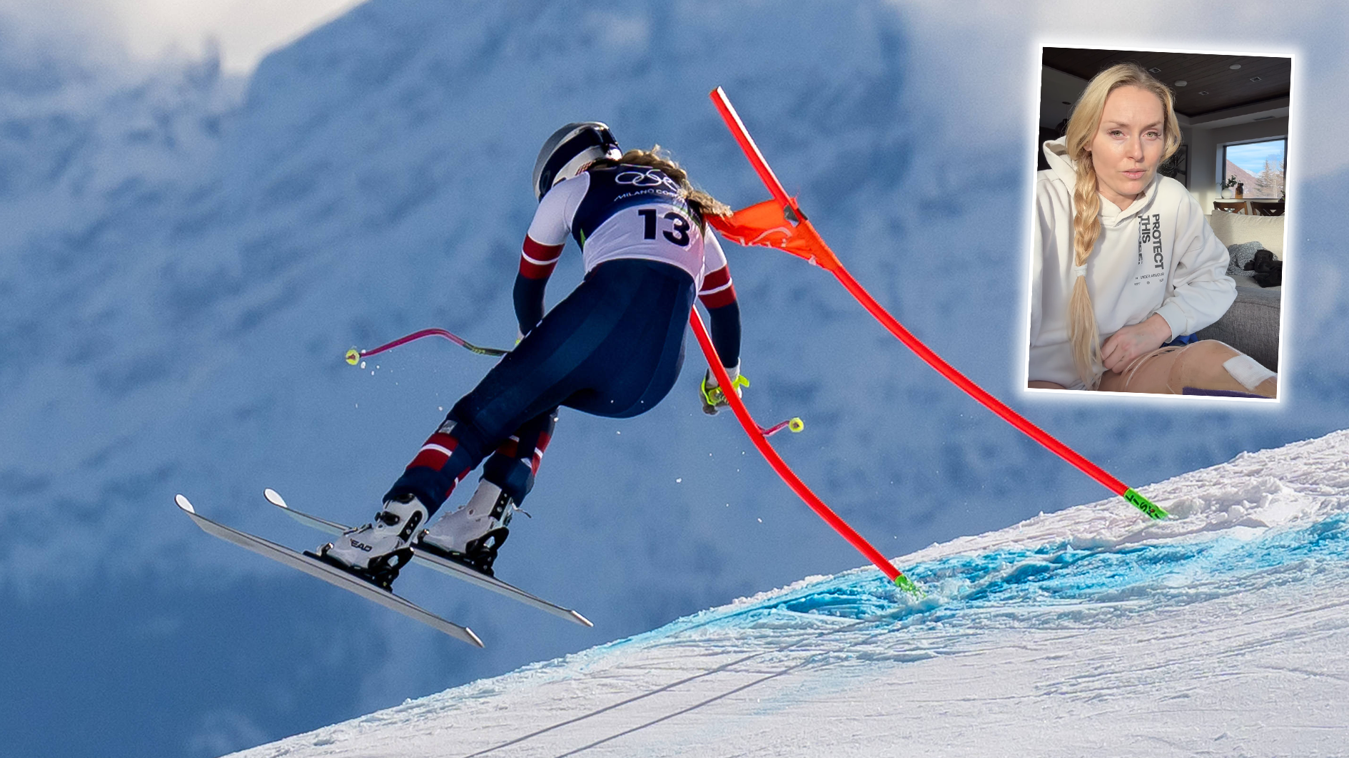 Olympia: Vonn mit Schock-Nachricht - Skistar entging nur knapp einer Amputation