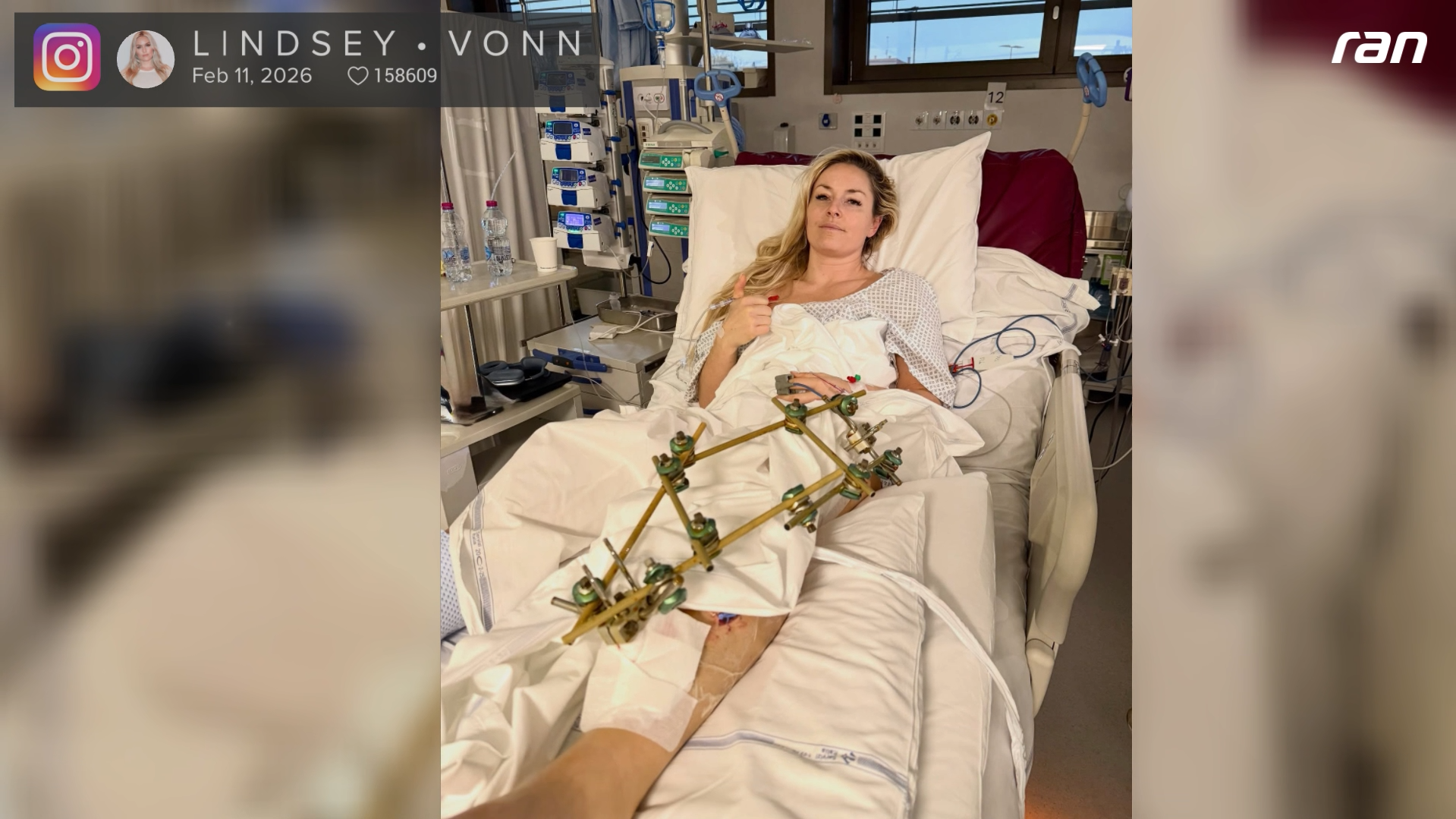 Olympia 2026: Heftiges Foto! Lindsey Vonn meldet sich aus Krankenhaus