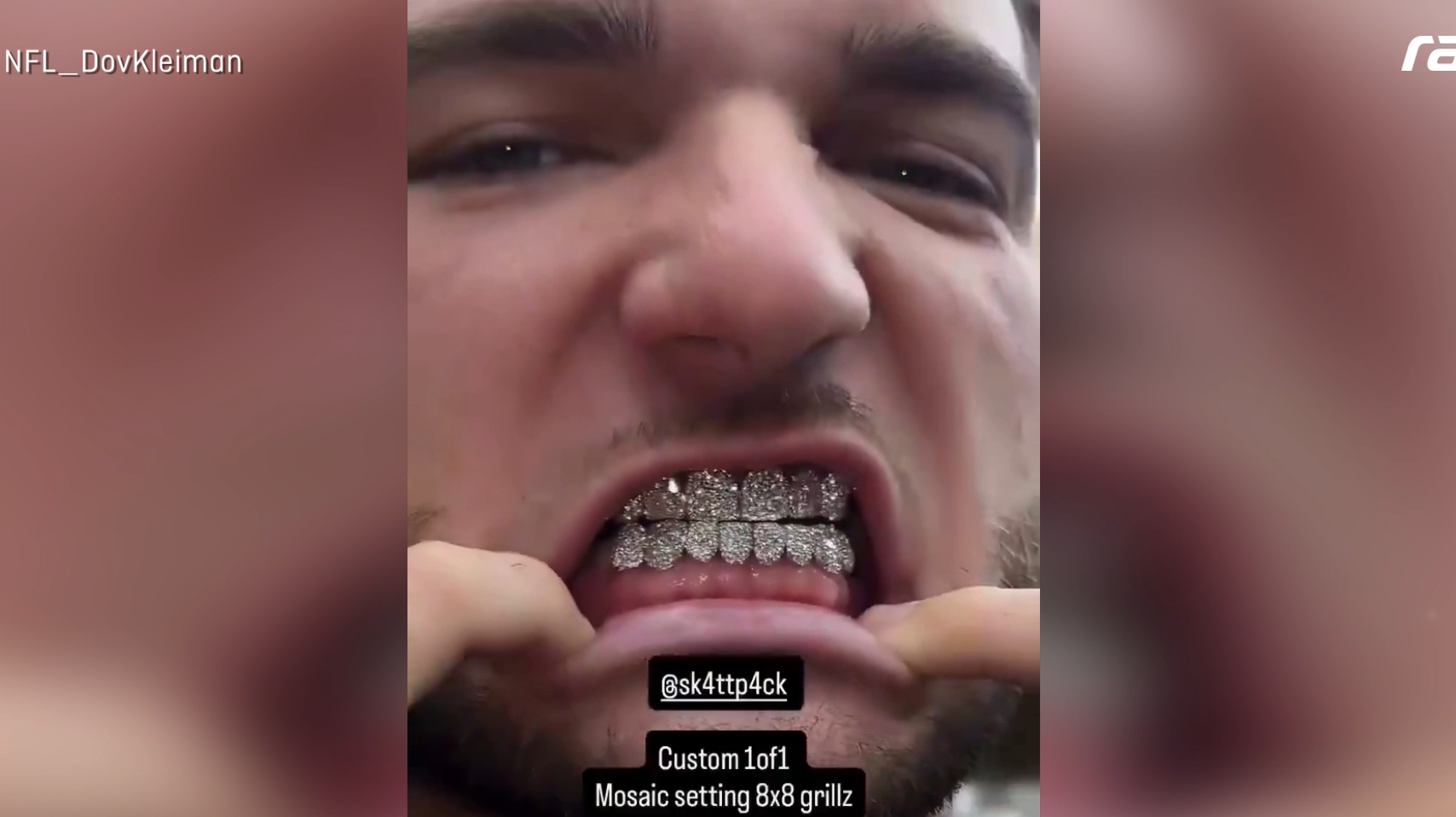 NFL-Star Cam Skattebo flext mit 50k-Grillz