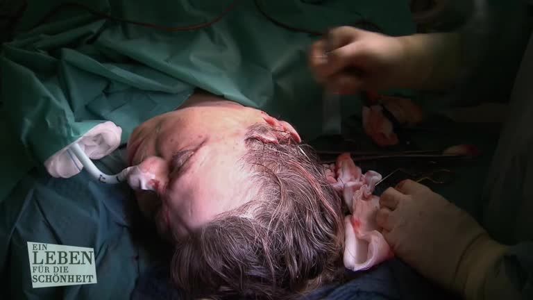 Folge 5: Facelifting