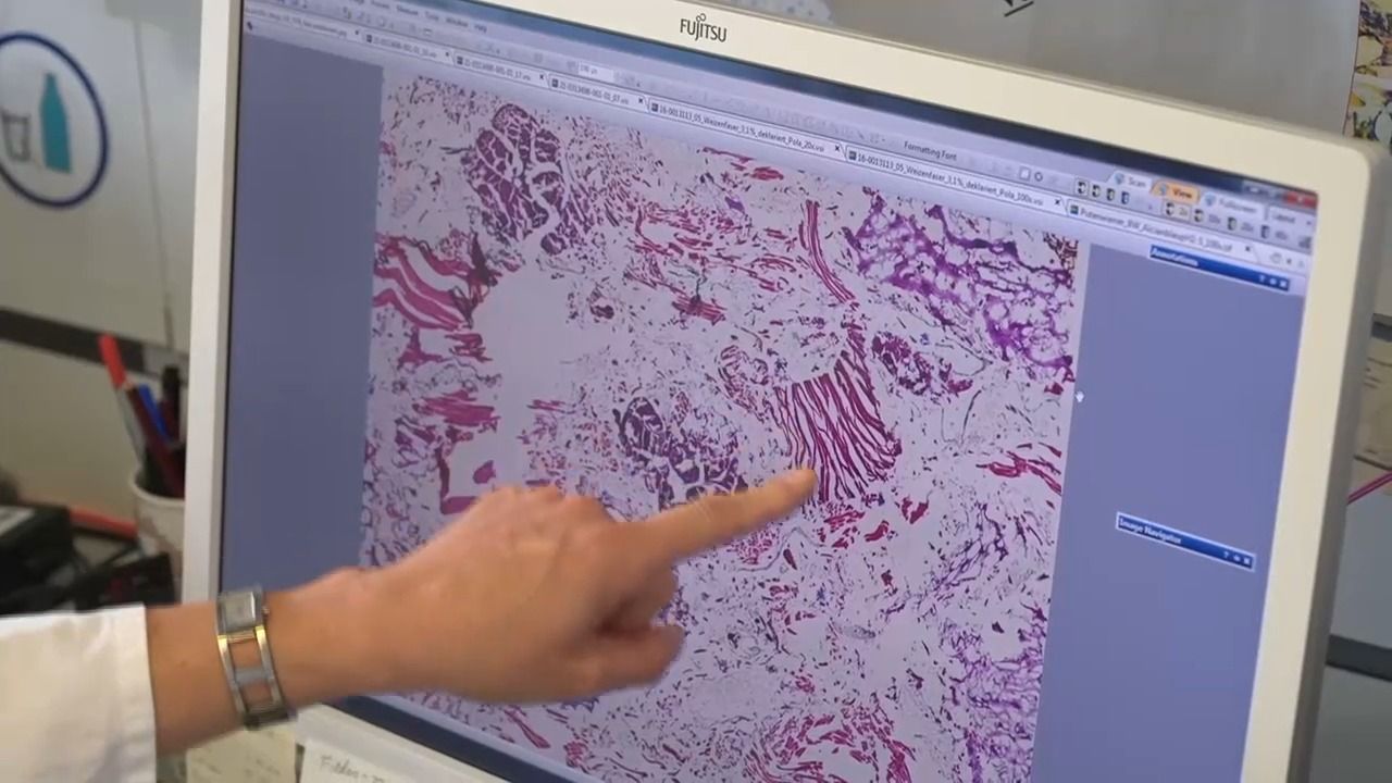 Lebensmittel im Check: Was ist nach Ablauf noch essbar?