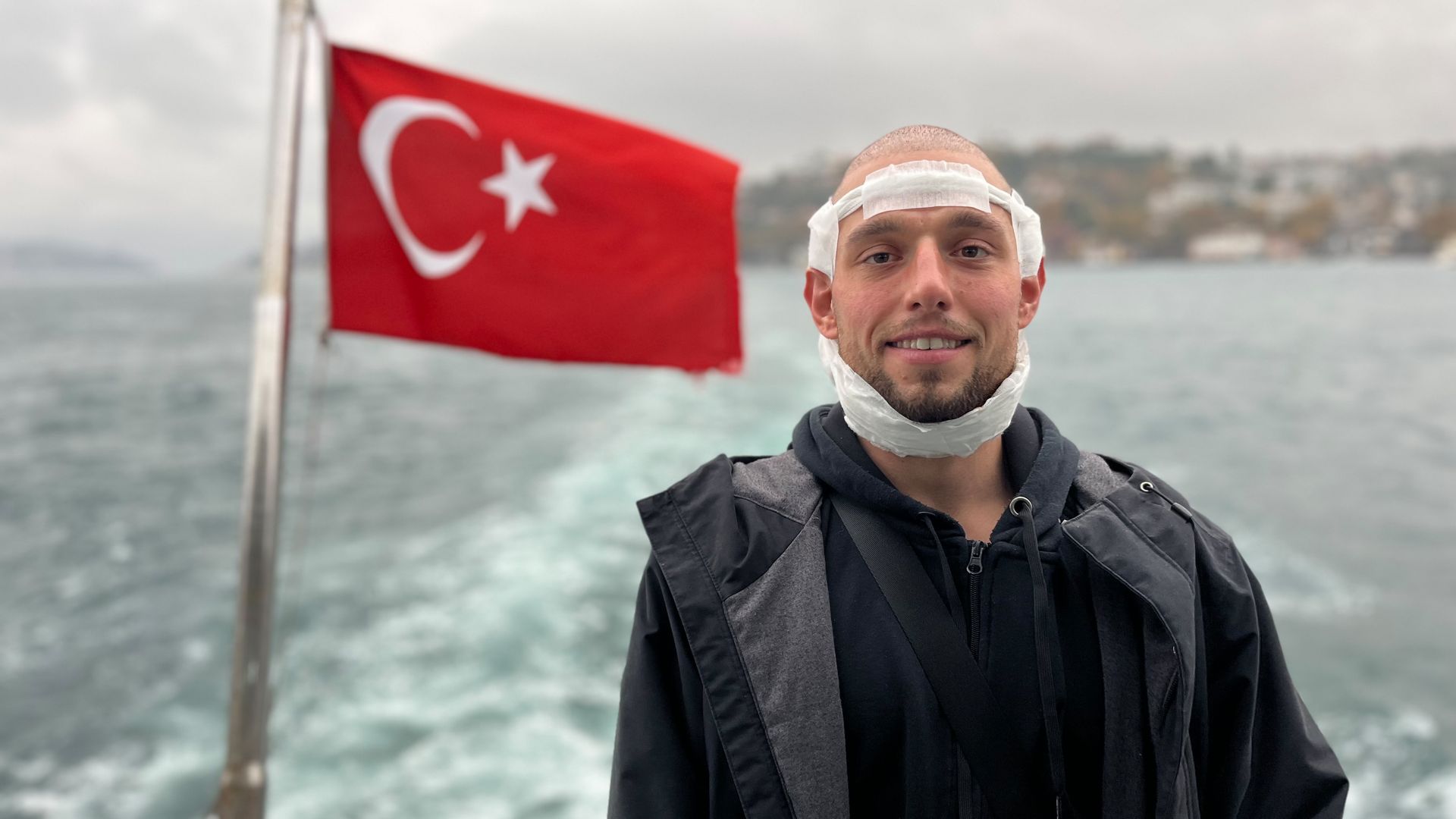 Medizin-Tourismus in der Türkei: Wie luxuriös sind die All-Inclusive OP-Pakete?