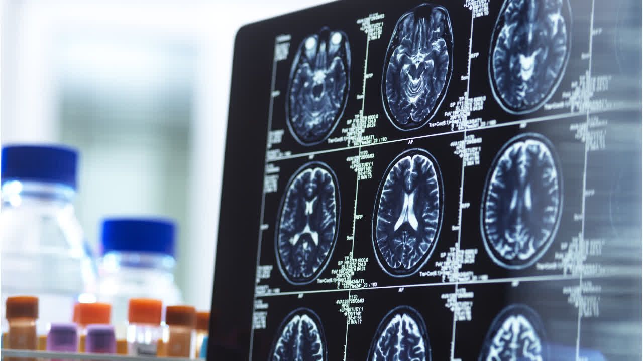 Wie künstliche Intelligenz Ärzte unterstützen könnte